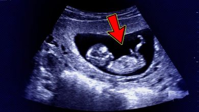 شكل الجنين في الشهر الثالث الذكر